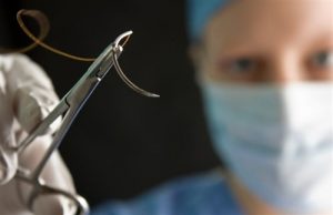 hair transplant training courses