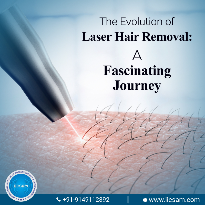 The History of Laser Hair Removal and How It Has Evolved